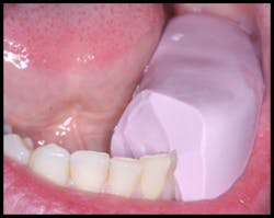 Pmm Novy Gi Fig06 Pmm Novy Gi Fig06