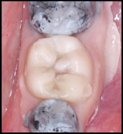 Pmm Novy Gi Fig07 Pmm Novy Gi Fig07