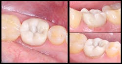 Pmm Novy Gi Fig08 Pmm Novy Gi Fig08