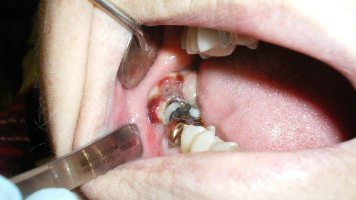 Content Dam Diq Online Articles 2017 04 17apr6bcpath24tx Thumb