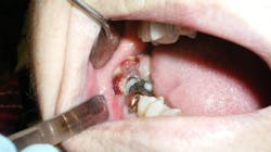 Content Dam Diq Online Articles 2017 04 17apr6bcpath24tx Thumb Content Dam Diq Online Articles 2017 04 17apr6bcpath24tx Thumb