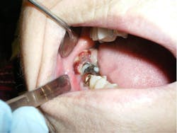 17apr6bcpath24tx 17apr6bcpath24tx