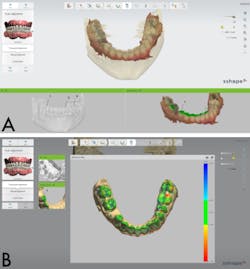 Bencharit Implant Form2 Fig03a03b Bencharit Implant Form2 Fig03a03b