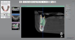 Bencharit Implant Form2 Fig04 Bencharit Implant Form2 Fig04