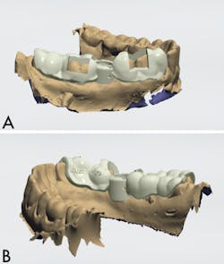 Bencharit Implant Form2 Fig05a05b Bencharit Implant Form2 Fig05a05b