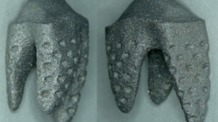 Content Dam Diq Online Articles 2017 03 Replicate Tooth 3 D Printed Thumb