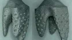 Content Dam Diq Online Articles 2017 03 Replicate Tooth 3 D Printed Thumb