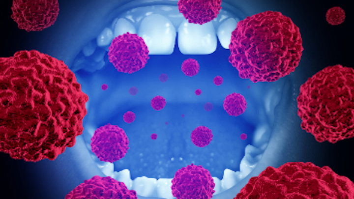 Content Dam Diq Online Articles 2017 04 Oral Cancer Concept Dreamstime Thumb