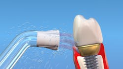 Jahn Plaque Seeker Fig02 Jahn Plaque Seeker Fig02