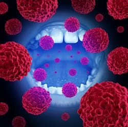 Oral Cancer Concept Dreamstime Oral Cancer Concept Dreamstime
