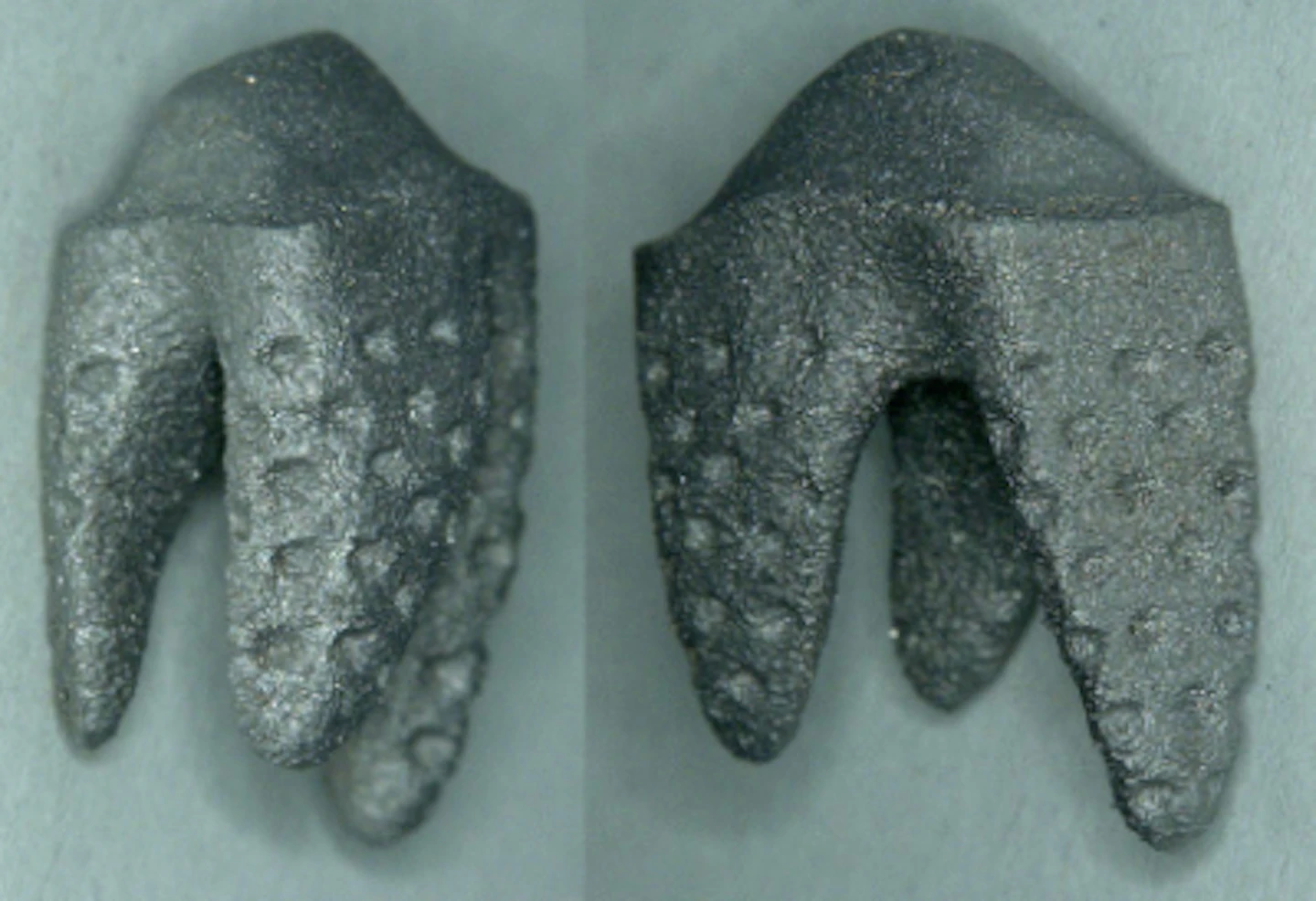 Natural Dental Implants Ag Announces Customized Tooth Replacement System At Ids 2017 Dentistryiq