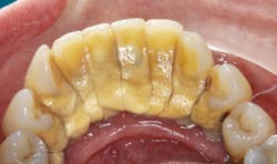 17apr6bcsimmons P01 17apr6bcsimmons P01