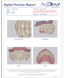 Don't be afraid of dentures: New technology simplifies denture ...