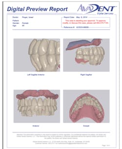 Avadent Fig01 Sm Avadent Fig01 Sm
