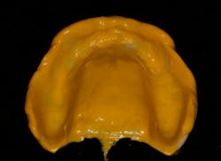 Avadent Fig04 Avadent Fig04