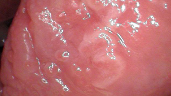 Content Dam Diq Online Articles 2017 04 17apr6bcpathcase25 Thumb