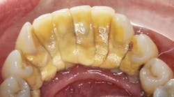 Content Dam Diq Online Articles 2017 04 17apr6bcsimmons Thumb Content Dam Diq Online Articles 2017 04 17apr6bcsimmons Thumb