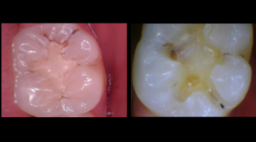 Content Dam Diq Online Articles 2017 04 Harr Canary Diqthumb