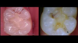 Content Dam Diq Online Articles 2017 04 Harr Canary Diqthumb Content Dam Diq Online Articles 2017 04 Harr Canary Diqthumb