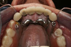 17jun1bckhanna P01 17jun1bckhanna P01