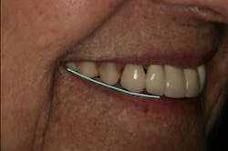 17jun1bckhanna P03 17jun1bckhanna P03