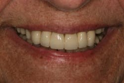 17jun1bckhanna P04 17jun1bckhanna P04