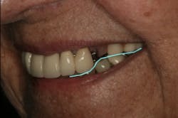 17jun1bckhanna P05 17jun1bckhanna P05