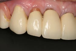 17jun1bckhanna P06 17jun1bckhanna P06