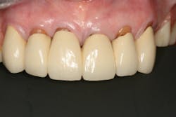 17jun1bckhanna P07 17jun1bckhanna P07