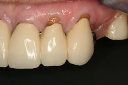 17jun1bckhanna P08 17jun1bckhanna P08