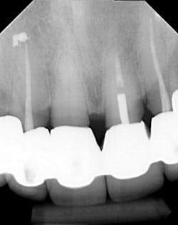 17jun1bckhanna P10 17jun1bckhanna P10