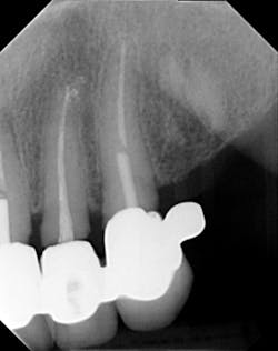 17jun1bckhanna P11 17jun1bckhanna P11