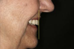 17jun1bckhanna P12 17jun1bckhanna P12