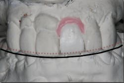 17jun1bckhanna P17 17jun1bckhanna P17