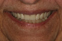 17jun1bckhanna P25 17jun1bckhanna P25