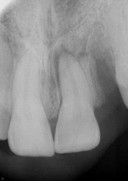 17jun1bcsimmons P01 17jun1bcsimmons P01