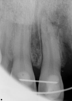 17jun1bcsimmons P03 17jun1bcsimmons P03