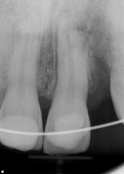 17jun1bcsimmons P04 17jun1bcsimmons P04