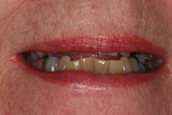 17may4bcwych P03 17may4bcwych P03