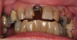 17may4bcwych P04 17may4bcwych P04