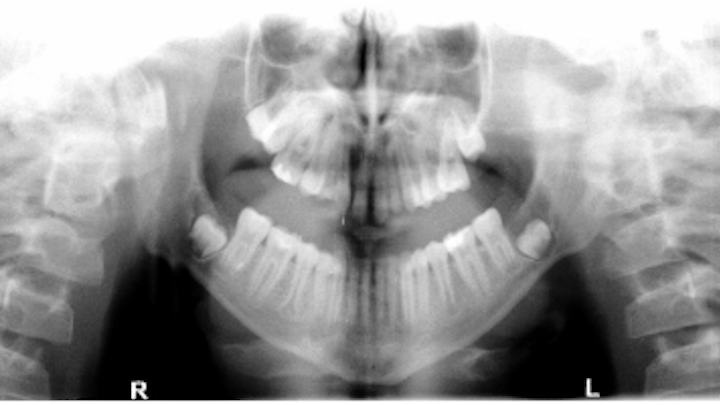 Content Dam Diq Online Articles 2017 05 17may4bcpathcase26 Thumb