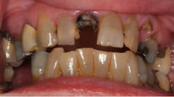 Content Dam Diq Online Articles 2017 05 17may4bcwych Thumb Content Dam Diq Online Articles 2017 05 17may4bcwych Thumb