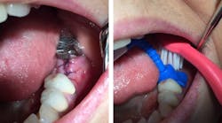 Content Dam Diq Online Articles 2017 05 Wingrove Postsurgical Home Care Diqthumb Content Dam Diq Online Articles 2017 05 Wingrove Postsurgical Home Care Diqthumb