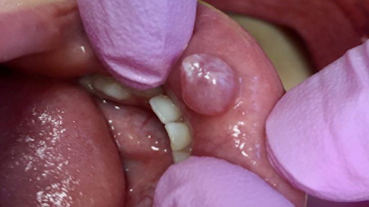 Content Dam Diq Online Articles 2017 06 17jun1bcpathcase27 Thumb