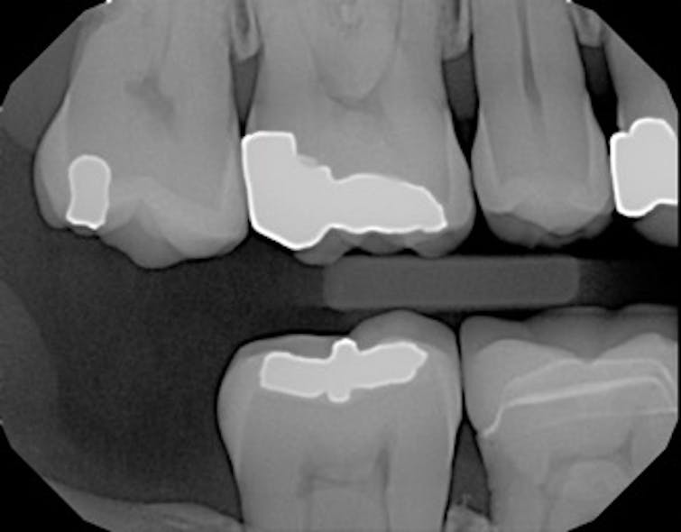 Dexis 05172017 Ar4 Picture1
