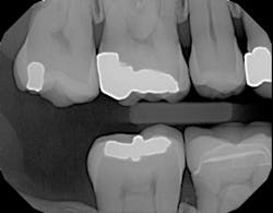 Dexis 05172017 Ar4 Picture1 Dexis 05172017 Ar4 Picture1