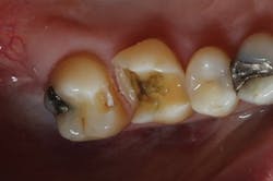 Dexis 05172017 Ar4 Picture3 Dexis 05172017 Ar4 Picture3