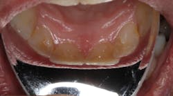 Content Dam Diq Online Articles 2017 06 Pmm Reflective Shields Plus Diqthumb Content Dam Diq Online Articles 2017 06 Pmm Reflective Shields Plus Diqthumb