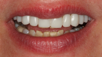 Content Dam Diq Online Articles 2017 06 Stonisch Diqthumb