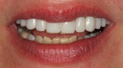 Content Dam Diq Online Articles 2017 06 Stonisch Diqthumb Content Dam Diq Online Articles 2017 06 Stonisch Diqthumb